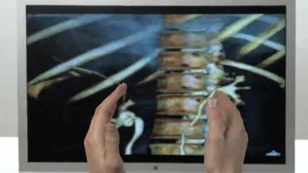 Ärzte müsse die Handschuhe nicht ausziehen, um Daten im Rechner nachzuschlagen.